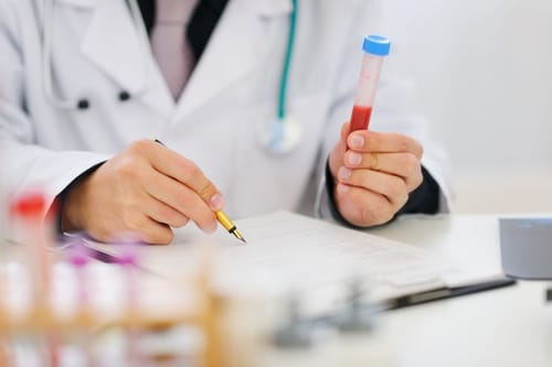 Closeup on hands of medical doctor holding blood sample and making notes. Blood testing is the primary method by which a doctor discovers if Testosterone Replacement Therapy is indicated. Learn more.