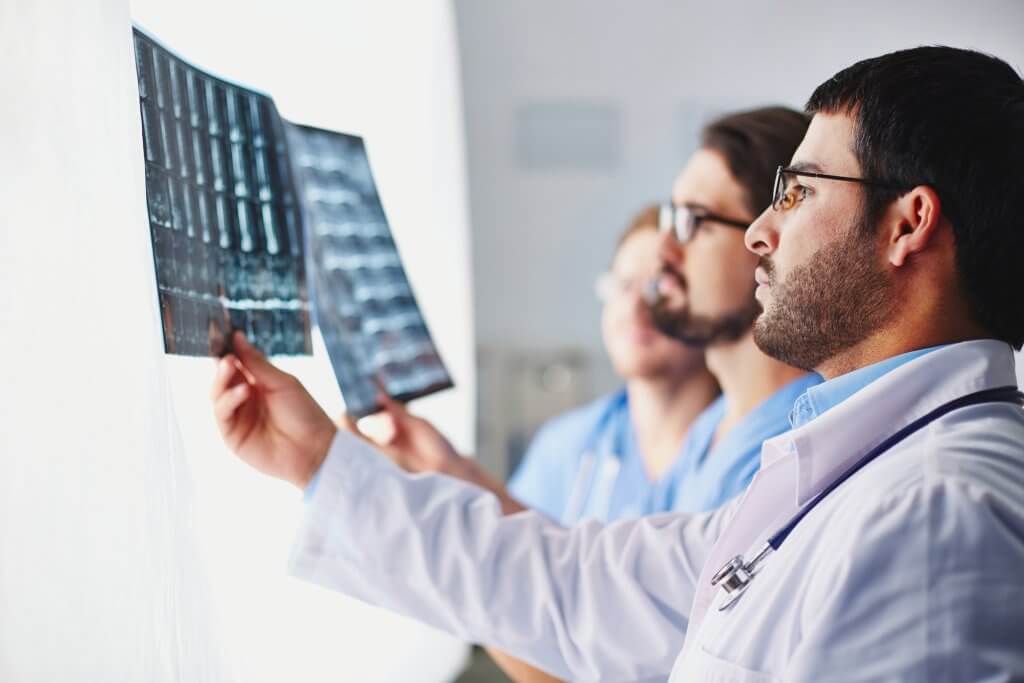 Tres profesionales de la medicina observan las radiografías, posiblemente considerando la conexión entre la testosterona y la recuperación del ictus.