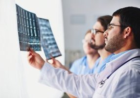 Three medical professionals look at X-ray scans, possibly considering the connection between testosterone and stroke recovery.